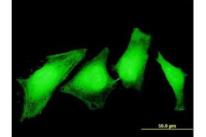 Immunofluorescence of monoclonal antibody to ASPA on HeLa cell.