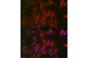 Immunofluorescence analysis of NIH/3T3 cells using RTKN Rabbit pAb (ABIN6129097, ABIN6147290, ABIN6147292 and ABIN6222455) at dilution of 1:100 (40x lens). (Rhotekin anticorps  (AA 254-513))