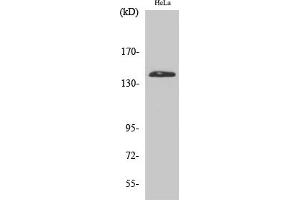 Western Blot analysis of various cells using PERK Polyclonal Antibody diluted at 1:2000. (PERK anticorps  (AA 30-110))