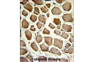 Formalin-fixed and paraffin-embedded human skeletal muscle reacted with CKIP-1 Antibody (N-term), which was peroxidase-conjugated to the secondary antibody, followed by DAB staining. (PLEKHO1 anticorps  (N-Term))