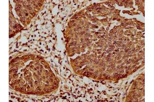 IHC image of ABIN7127557 diluted at 1:61.