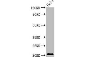 Western Blot Positive WB detected in: Hela whole cell lysate All lanes: ARL1 antibody at 5. (ARL1 anticorps  (AA 2-181))