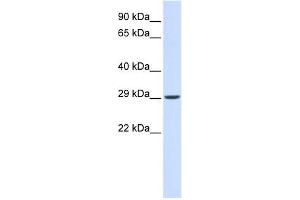 VTI1A antibody used at 1 ug/ml to detect target protein. (VTI1A anticorps)