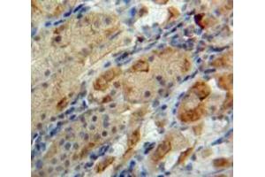 Used in DAB staining on fromalin fixed paraffin-embedded Stomach tissue (Neuromedin U anticorps  (AA 38-174))