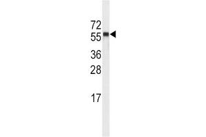 Western Blotting (WB) image for anti-Cytochrome P450, Family 4, Subfamily A, Polypeptide 11 (CYP4A11) antibody (ABIN3003554) (CYP4A11 anticorps)