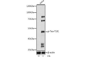 Western blot analysis of extracts of HeLa cells, using Phospho-Tau-T181 antibody (ABIN7268528) at 1:1000 dilution.