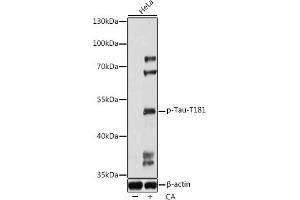 Western blot analysis of extracts of HeLa cells, using Phospho-Tau-T181 antibody (ABIN7268528) at 1:1000 dilution. (MAPT anticorps  (pThr181))