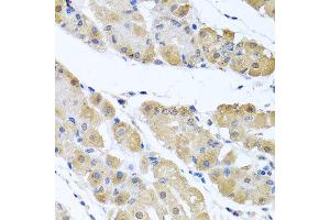 Immunohistochemistry of paraffin-embedded human gastric using OGFR antibody at dilution of 1:100 (x40 lens). (OGFR anticorps)