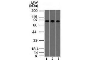 Western blot testing of human 1) A549, 2) HepG2 and 3) HCT-116 cell lysate with Villin antibody (clone VIL1/1314).