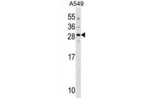 Western Blotting (WB) image for anti-Guanylate Cyclase Activator 1B (Retina) (GUCA1B) antibody (ABIN3000950) (GUCA1B anticorps)