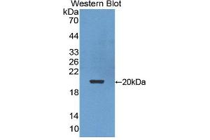 Figure. (POMP anticorps  (AA 1-141))