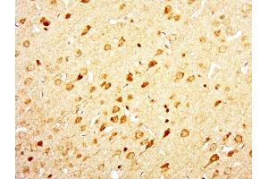 Paraformaldehyde-fixed, paraffin embedded rat brain, Antigen retrieval by boiling in sodium citrate buffer (pH6.