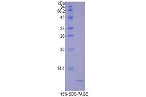 SDS-PAGE (SDS) image for Urocortin 2 (UCN2) (AA 23-107) protein (His tag) (ABIN2122312)