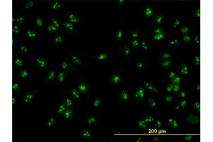 Immunofluorescence of monoclonal antibody to HSPC111 on HeLa cell. (NOP16 anticorps  (AA 1-178))