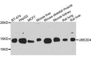 Western blot analysis of extract of various cells, using UBE2D4 antibody. (UBE2D4 anticorps)