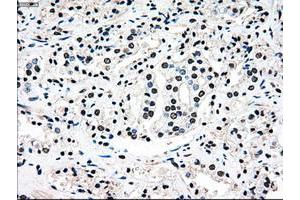 Image no. 9 for anti-Mitogen-Activated Protein Kinase Kinase 4 (MAP2K4) antibody (ABIN1499481)