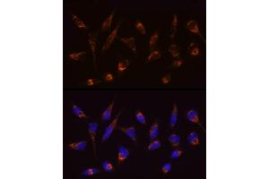 Immunofluorescence analysis of HeLa cells using [KO Validated] SLC25/ Rabbit mAb (ABIN7270428) at dilution of 1:100 (40x lens). (SLC25A4 anticorps)