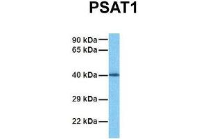 Host:  Rabbit  Target Name:  PSAT1  Sample Tissue:  Human Fetal Kidney  Antibody Dilution:  1. (PSAT1 anticorps  (N-Term))