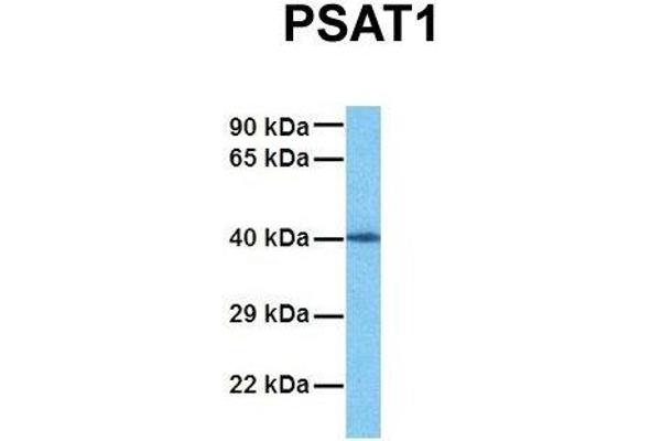 PSAT1 anticorps  (N-Term)