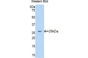 Western blot analysis of the recombinant protein. (PYGL anticorps  (AA 73-267))