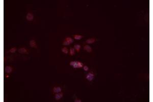 ABIN6277442 staining Hela cells by IF/ICC. (TRIM63 anticorps  (N-Term))