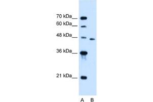 Western Blotting (WB) image for anti-Solute Carrier Family 16, Member 12 (Monocarboxylic Acid Transporter 12) (SLC16A12) antibody (ABIN2462789) (SLC16A12 anticorps)