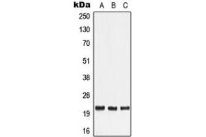 Western blot analysis of TNF beta expression in HeLa (A), Human tonsil (B), Human lymph node (C) whole cell lysates. (LTA anticorps  (Center))