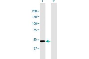 Western Blot analysis of CPEB1 expression in transfected 293T cell line by CPEB1 MaxPab polyclonal antibody. (CPEB1 anticorps  (AA 1-486))