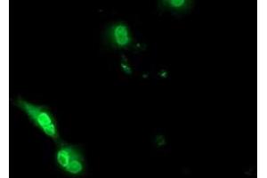 Immunofluorescence (IF) image for anti-EPM2A (Laforin) Interacting Protein 1 (EPM2AIP1) antibody (ABIN1498042) (EPM2AIP1 anticorps)