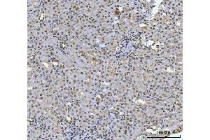 IHC analysis of HOXC4 using anti-HOXC4 antibody (ABIN7603059). (HOXC4 anticorps  (Middle Region))