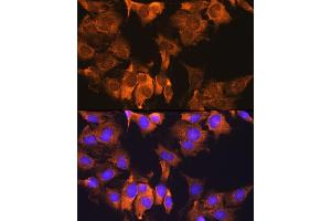 Immunofluorescence analysis of C6 cells using CDV3 Rabbit pAb (ABIN7266240) at dilution of 1:100.