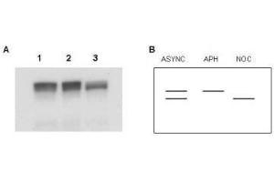 Western blot using  Affinity Purified anti-MCM2 antibody shows detection of both phosphorylated and unphosphorylated MCM2 present in nuclear extracts from elutriated human cells (MO59K/K562). (MCM2 anticorps  (AA 21-31))