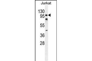 CWC22 Antibody (N-term) (ABIN654743 and ABIN2844428) western blot analysis in Jurkat cell line lysates (35 μg/lane). (CWC22 anticorps  (N-Term))