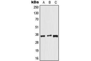 Western blot analysis of ALX3 expression in HeLa (A), NIH3T3 (B), rat brain (C) whole cell lysates.
