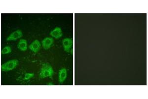 Immunofluorescence analysis of HuvEc cells, using Tyrosine Hydroxylase (epitope around residue 19) antibody (ABIN5976157).