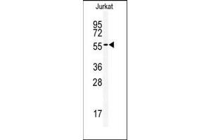 Image no. 1 for anti-Activin A Receptor Type II-Like 1 (ACVRL1) (C-Term) antibody (ABIN360125)