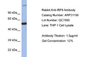 WB Suggested Anti-IRF8 Antibody   Titration: 1. (IRF8 anticorps  (C-Term))