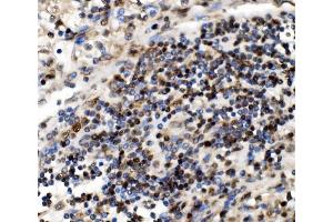 IHC analysis of NOLA1/GAR1 using anti-NOLA1/GAR1 antibody (ABIN7602076). (GAR1 anticorps  (AA 58-165))