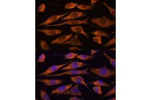 Immunofluorescence analysis of L929 cells using MTMR9 antibody (ABIN6128253, ABIN6144163, ABIN6144164 and ABIN6217000) at dilution of 1:100.