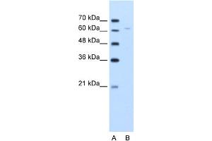 WB Suggested Anti-DLAT Antibody Titration:  5. (DLAT anticorps  (N-Term))