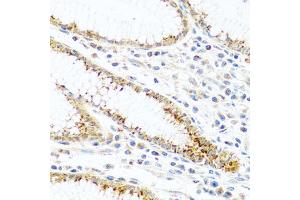 Immunohistochemistry of paraffin-embedded human stomach using FAM3B antibody (ABIN5970440) at dilution of 1/100 (40x lens). (FAM3B anticorps)