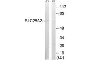 Western blot analysis of extracts from Jurkat cells, using SLC28A2 Antibody. (SLC28A2 anticorps  (AA 371-420))