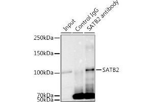 Immunoprecipitation analysis of 300 μg extracts of K-562 cells using 3 μg S antibody (ABIN7270152). (SATB2 anticorps)