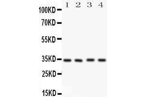 Anti-Caspase-7(P11) antibody, Western blotting All lanes: Anti CASP7(p11)  at 0.