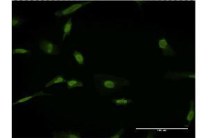 Immunofluorescence of monoclonal antibody to SLC11A2 on HeLa cell.