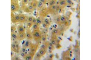 Used in DAB staining on fromalin fixed paraffin-embedded Liver tissue (Lipotropin, beta - (AA 179-267) anticorps)