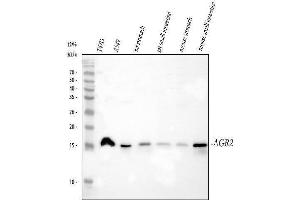 Western blot analysis of AGR2 using anti-AGR2 antibody (ABIN5518726). (AGR2 anticorps  (AA 21-175))