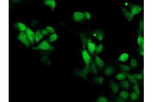 Image no. 3 for anti-Spermine Synthase, SMS (SMS) antibody (ABIN1501099) (SMS anticorps)