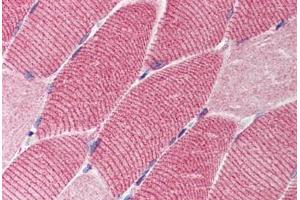 Human Skeletal Muscle (formalin-fixed, paraffin-embedded) stained with TSC1 antibody ABIN214539 at 2. (TSC1 anticorps)