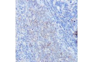 Immunohistochemistry of paraffin-embedded rat spleen using IFNGR1 Rabbit pAb (ABIN6127566, ABIN6142197, ABIN6142198 and ABIN6221420) at dilution of 1:100 (40x lens). (IFNGR1 anticorps  (AA 270-489))